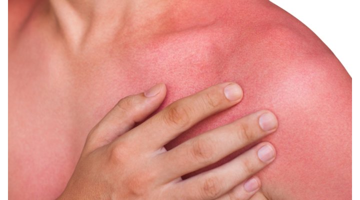 Dopo-sole: cosa serve davvero alla tua pelle Dopo-sole: cosa serve davvero alla tua pelle