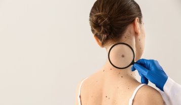 Nei ed esposizione solare: consigli utili