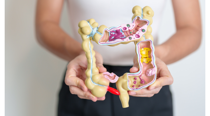 Come mantenere una buona salute intestinale: il ruolo dei probiotici e degli alimenti fermentati Come mantenere una buona salute intestinale: il ruolo dei probiotici e degli alimenti fermentati